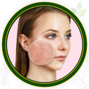 Open Pores & Uneven Skin